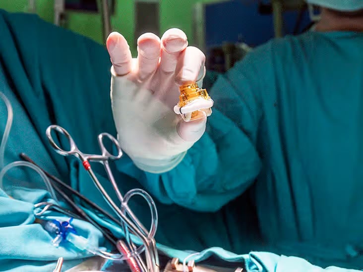 Heart Valve Replacement: Why Choose India for Your Surgery?