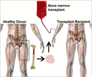 Is Bone Marrow Transplant Worth the Cost? A Financial and Medical Guide for International Patients in India