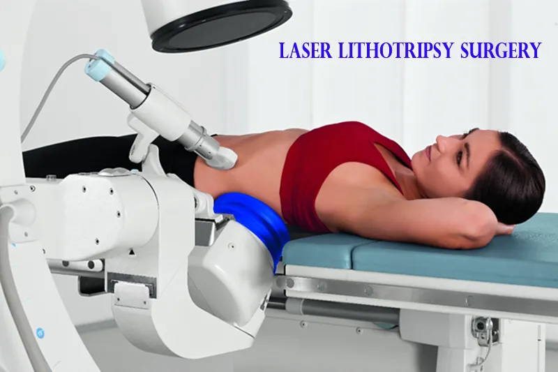 Laser Lithotripsy in India: Procedure, Technology, Cost and Recovery