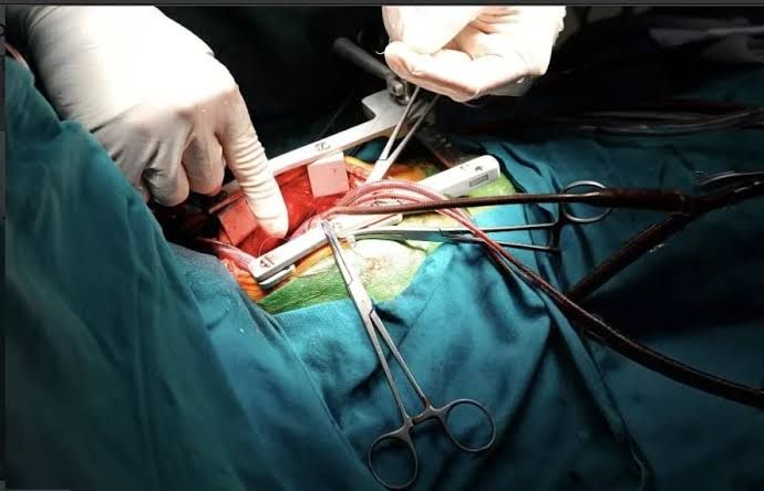 Paediatric Heart Surgery in India: Costs, Technologies, and Outcomes