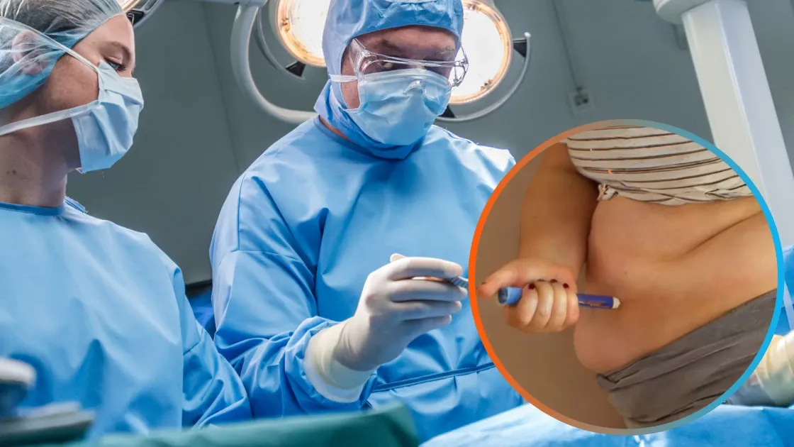 Type 2 Diabetes Surgery in India: Can Bariatric or Metabolic Surgery Reverse Diabetes?