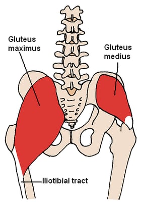 Buttocks Lift (Gluteal Lift) - Image 3