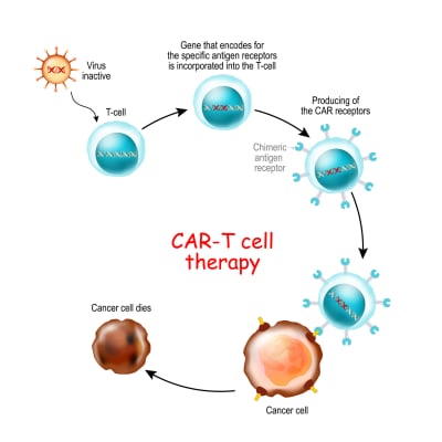 CAR T-Cell Therapy - Image 2