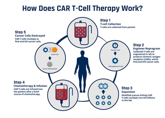 CAR T-Cell Therapy - Image 3
