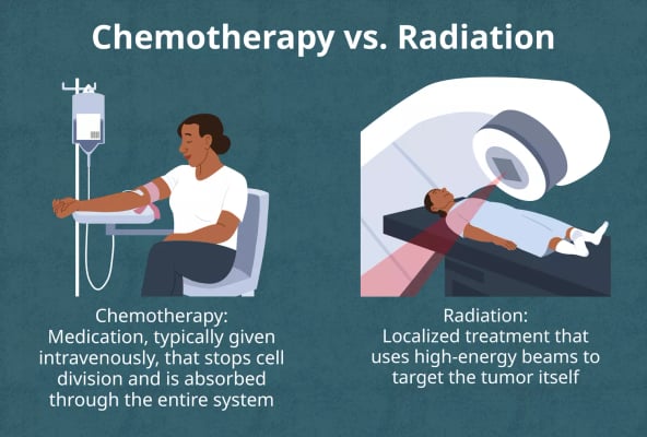 Chemotherapy - Image 3