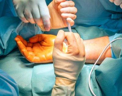 Hand Microsurgery - Image 2