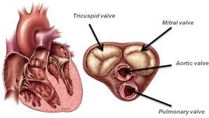 Heart Double Valve Replacement - Image 2