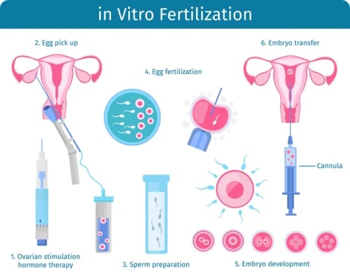 IVF Treatment - Image 3