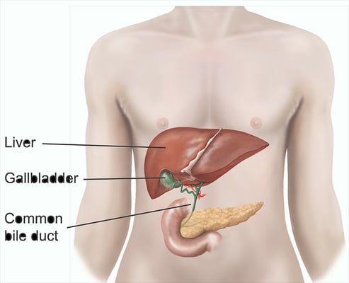 Laparoscopic Cholecystectomy - Gallbladder Removal - Image 2