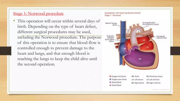 Norwood Procedure - Image 3