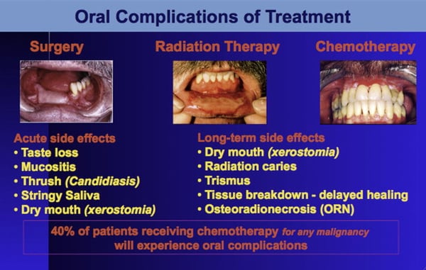 علاج سرطان الفم - Image 3