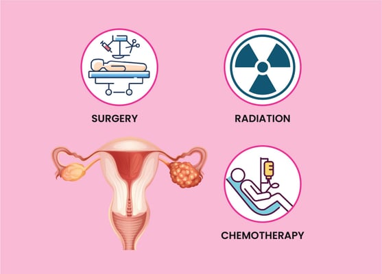 علاج سرطان المبيض - Image 2