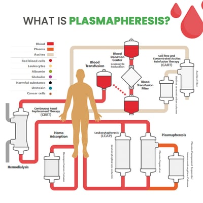 Plasmapheresis